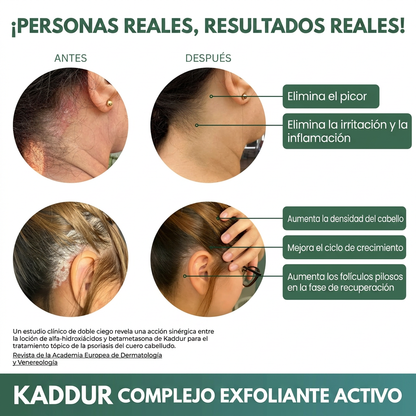 Scrub Capilar Kaddur, Adios psoriasis